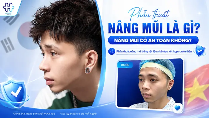 Phẫu thuật nâng mũi là gì? Nâng mũi có an toàn không?