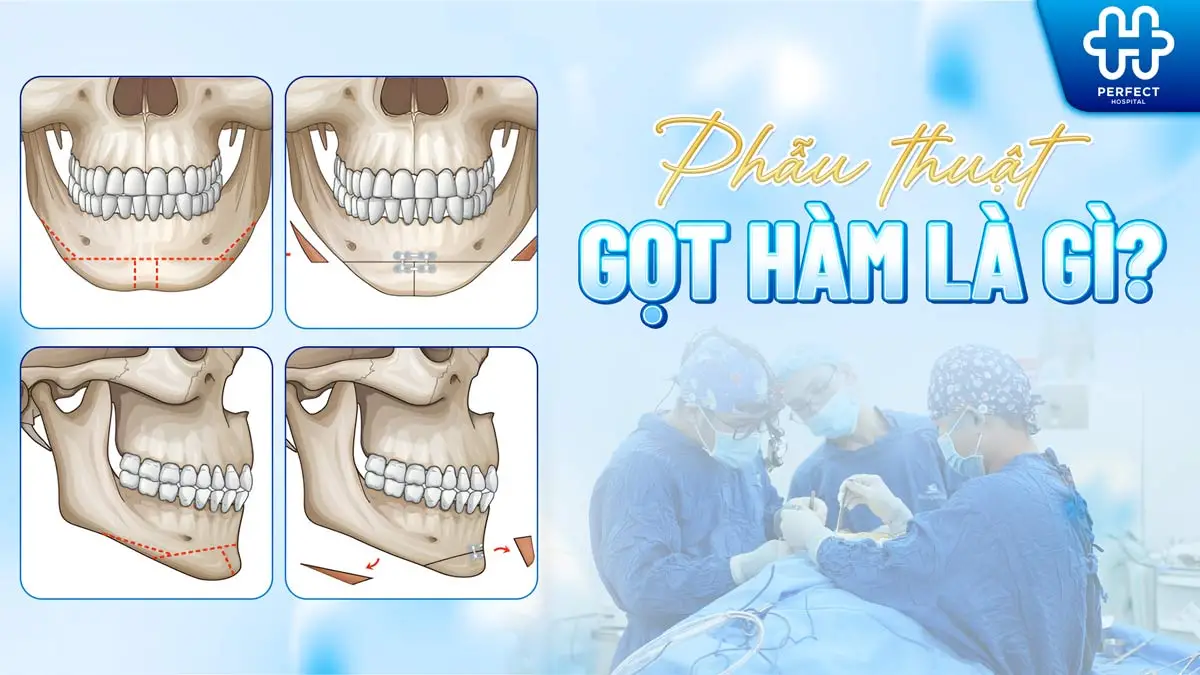 Phẫu thuật gọt hàm là gì? Gọt hàm có nguy hiểm không?