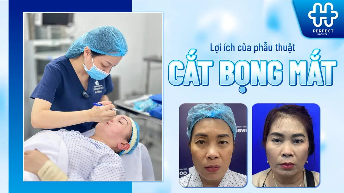 Cắt bọng mắt là gì? Tìm hiểu lợi ích, quy trình và chi phí