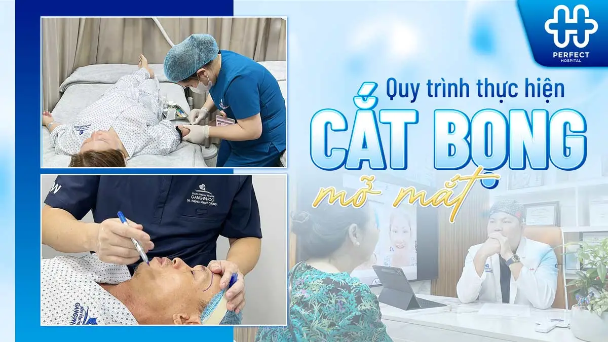 Cắt bọng mắt là gì? Tìm hiểu lợi ích, quy trình và chi phí