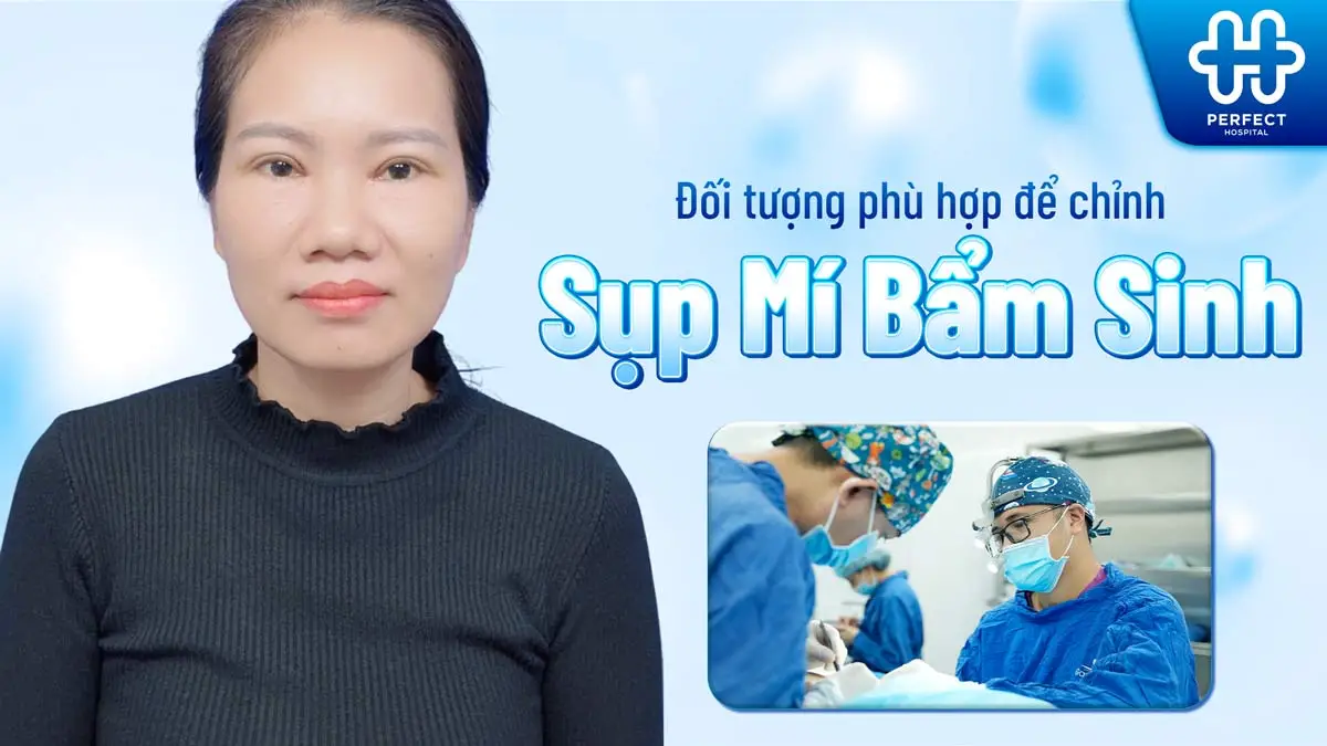 Chỉnh sụp mí bẩm sinh là gì? Có nên thực hiện không?