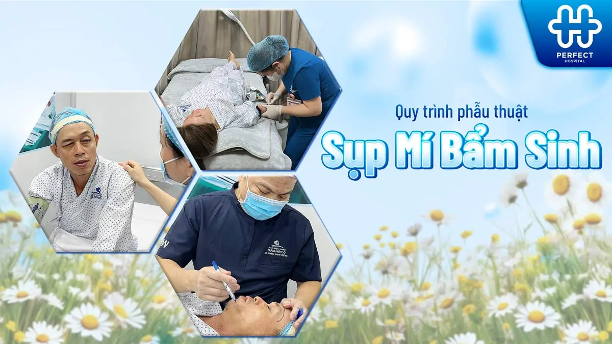 Chỉnh sụp mí bẩm sinh là gì? Có nên thực hiện không?