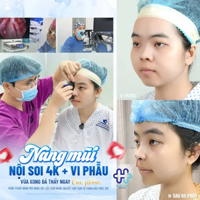 Nâng mũi bọc sụn là gì? Nâng mũi bọc sụn có tốt không?