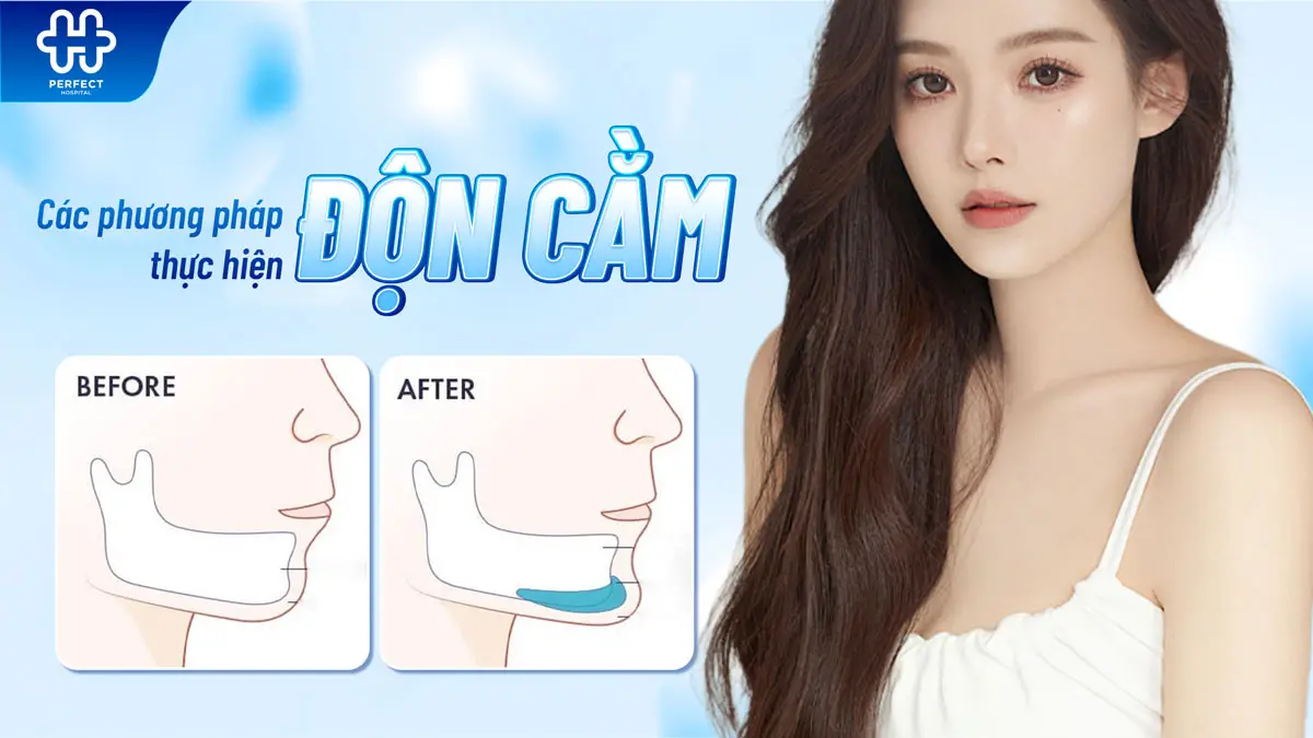 Độn cằm là gì? Những điều cần biết trước khi thực hiện