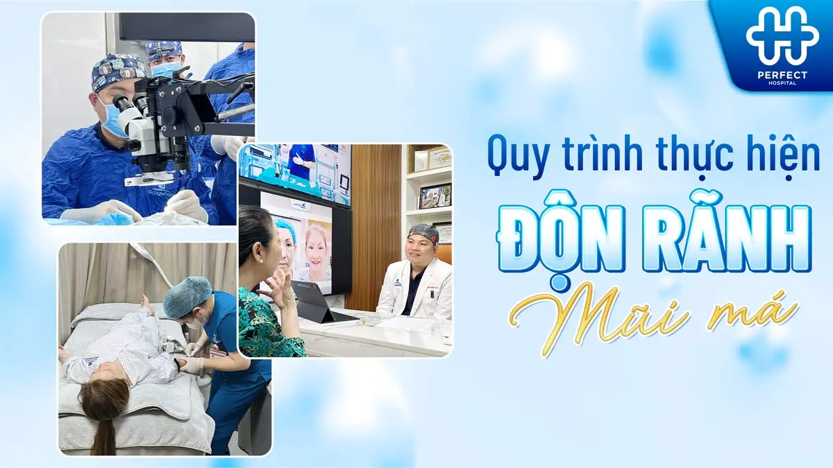 Độn rãnh mũi má : Quy trình, chi phí và lưu ý khi thực hiện