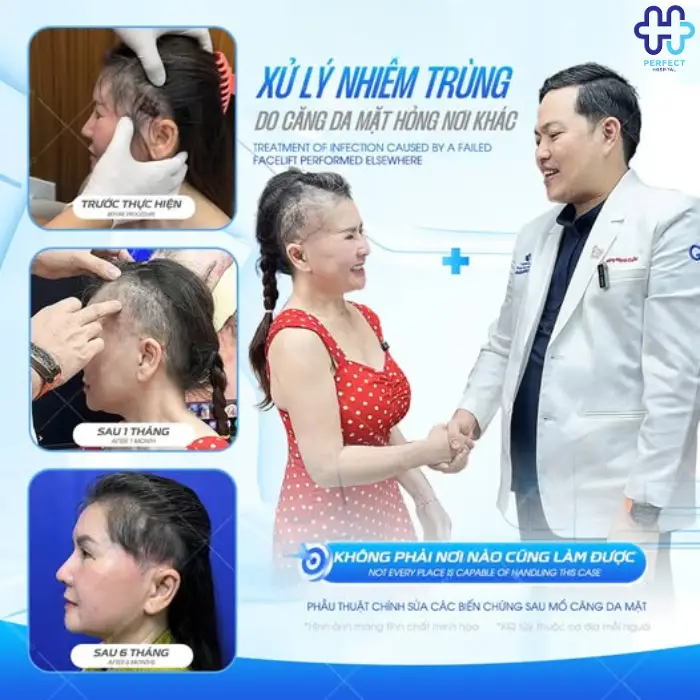 Sửa sẹo căng da mặt: Quy trình thực hiện và chi phí