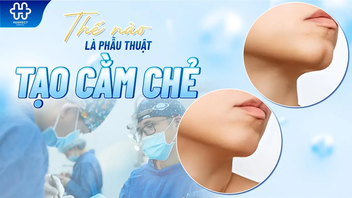 tạo cằm chẻ