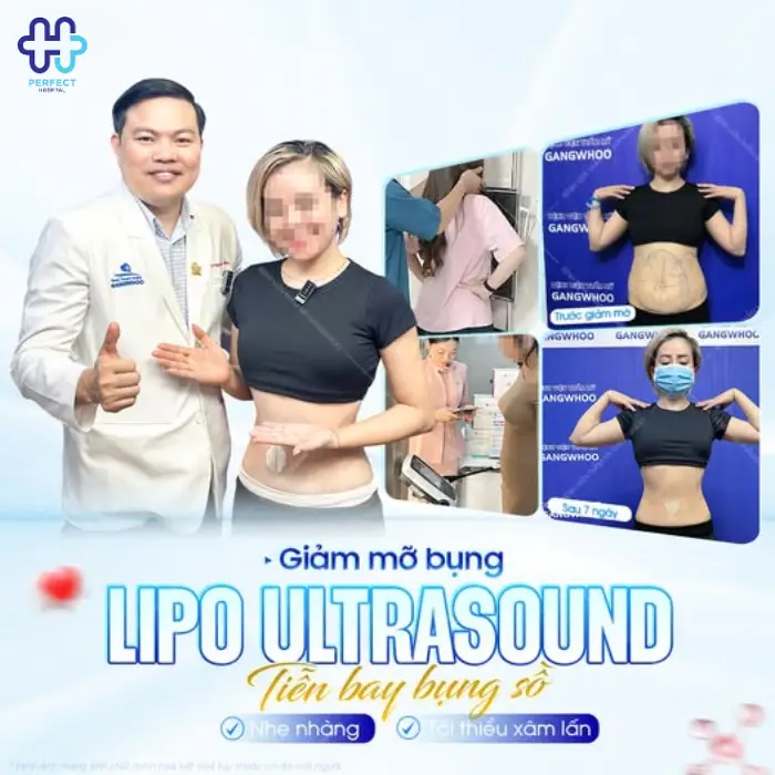 Hút mỡ bắp tay: Chi phí và quy trình thực hiện chi tiết