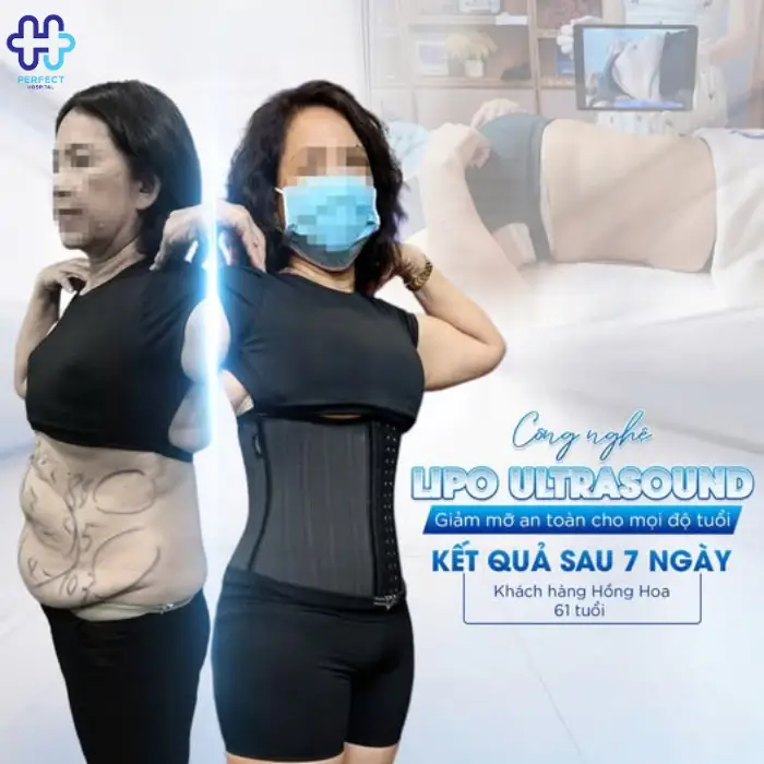 Hút mỡ eo, hông là gì? Những điều bạn cần biết