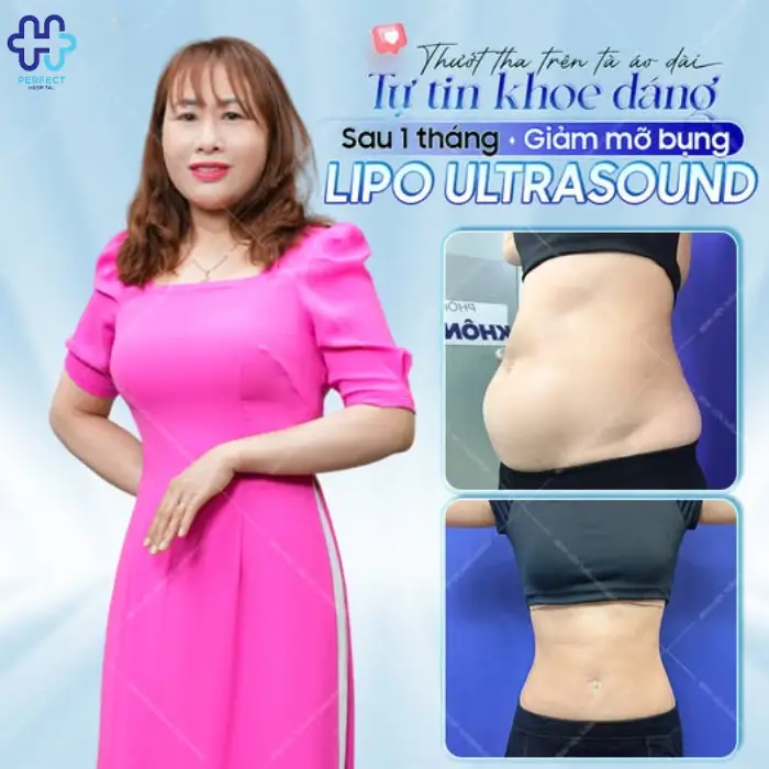 Hút mỡ eo, hông là gì? Những điều bạn cần biết