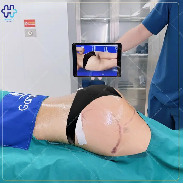 Hút mỡ mông là gì? Hút mỡ mông có an toàn không?