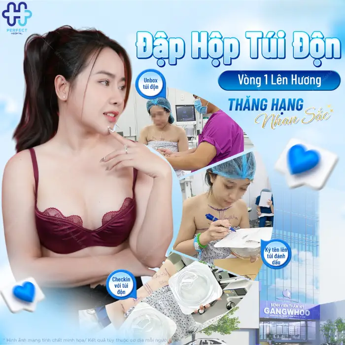 Nâng ngực túi mentor: Ưu điểm và quy trình thực hiện