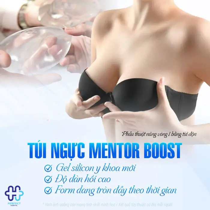 Nâng ngực túi mentor: Ưu điểm và quy trình thực hiện