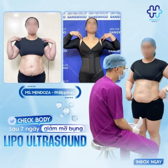 Căng da bụng là gì? Căng da vùng bụng có an toàn không?