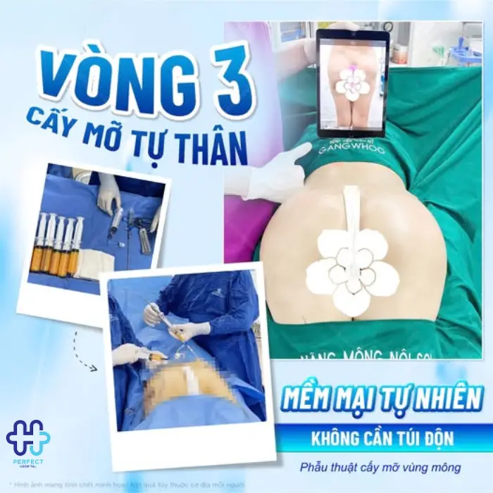 Cấy mỡ nâng mông là gì? Cấy mỡ nâng mông có an toàn không?