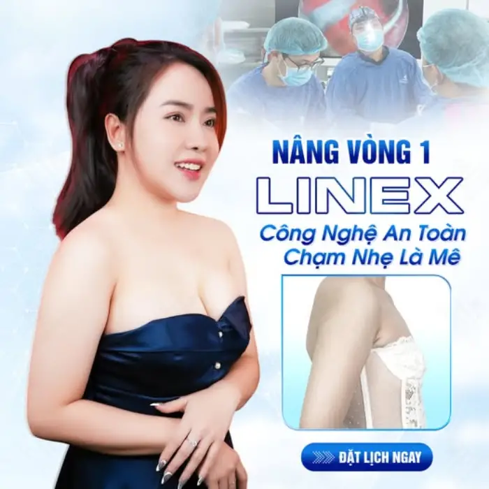 Nâng ngực line X là gì? Những điều bạn nên biết