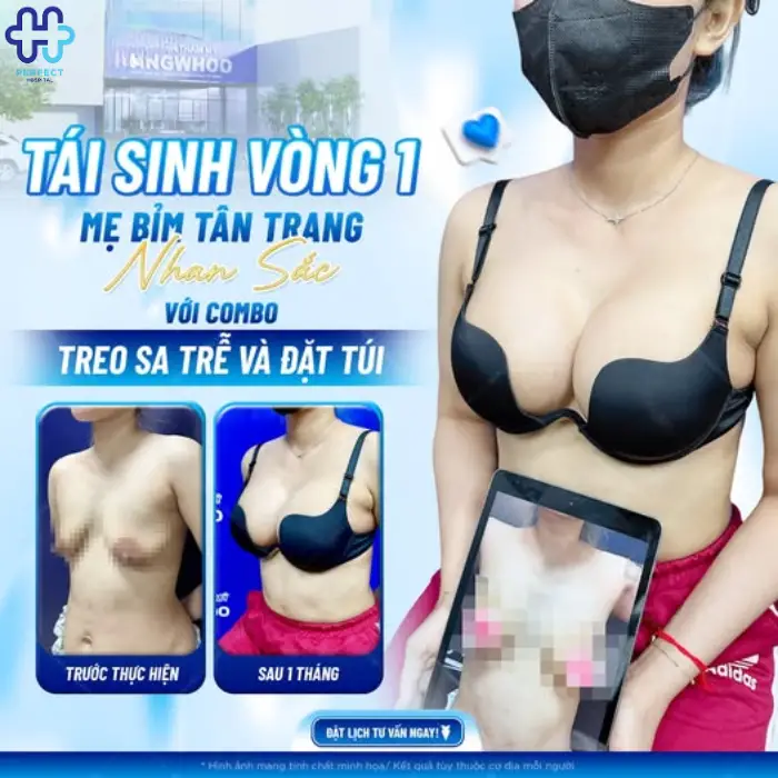 Thu gọn ngực phì đại: Ưu điểm và quy trình thực hiện