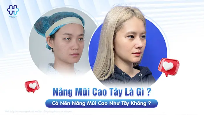 Nâng Mũi Cao Tây Là Gì? Có Nên Nâng Mũi Cao Như Tây Không?