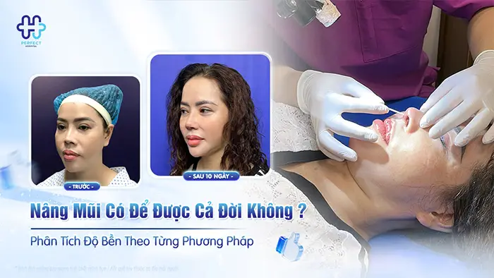 Nâng Mũi Có Để Được Cả Đời Không? Phân Tích Độ Bền Theo Từng Phương Pháp