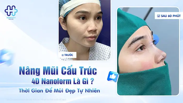 Nâng Mũi Cấu Trúc 4D Nanoform Là Gì? Công Nghệ Tạo Dáng Mũi Hiện Đại