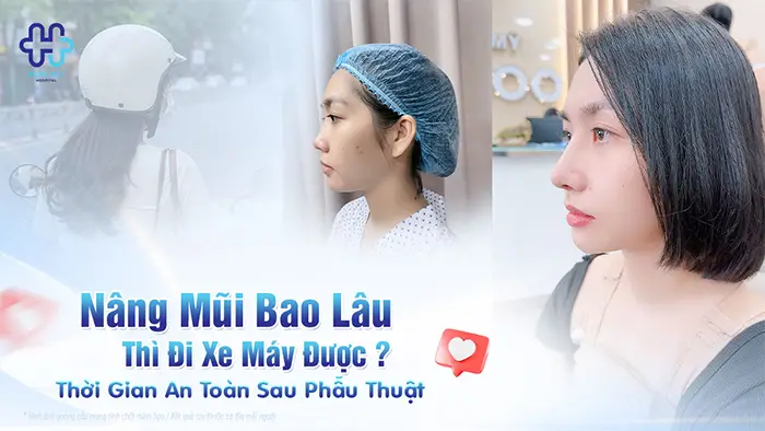 Nâng Mũi Bao Lâu Thì Đi Xe Máy Được? Thời Gian An Toàn Sau Phẫu Thuật