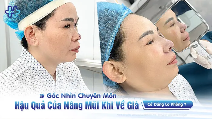 Hậu Quả Của Nâng Mũi Khi Về Già Có Đáng Lo Không? Góc Nhìn Chuyên Môn
