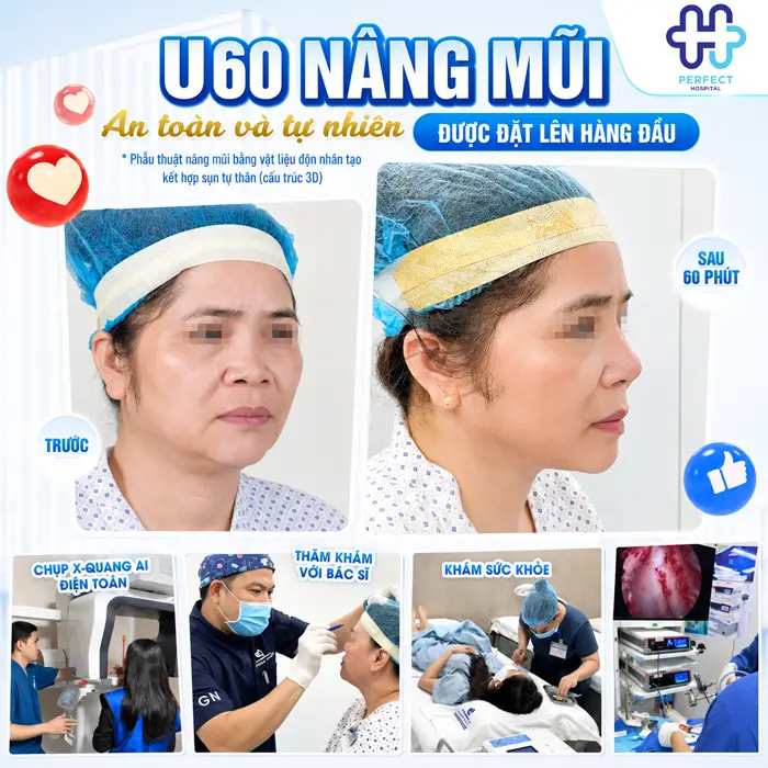 Hậu Quả Của Nâng Mũi Khi Về Già Có Đáng Lo Không? Góc Nhìn Chuyên Môn