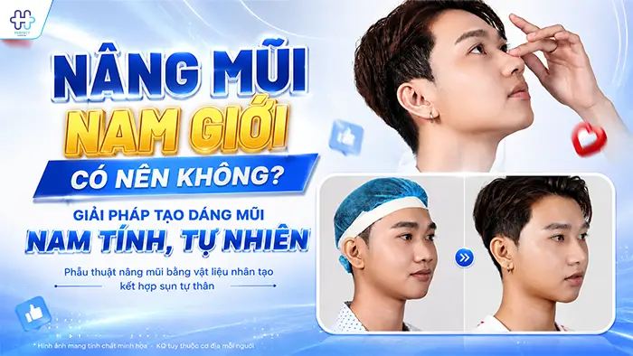 Nâng Mũi Nam Giới Có Nên Không? Giải Pháp Tạo Dáng Mũi Nam Tính, Tự Nhiên