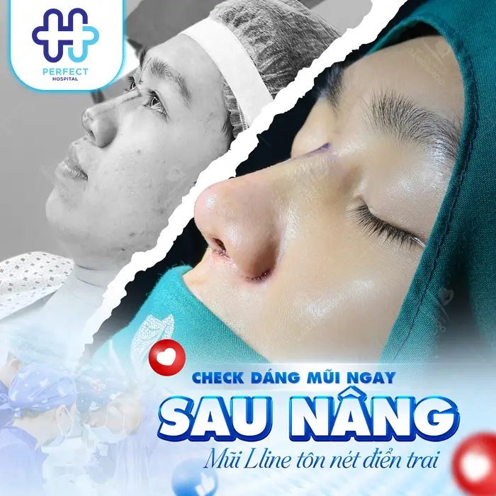 Nâng Mũi Bao Lâu Thì Được Nằm Nghiêng? Thời Gian Hồi Phục Chuẩn