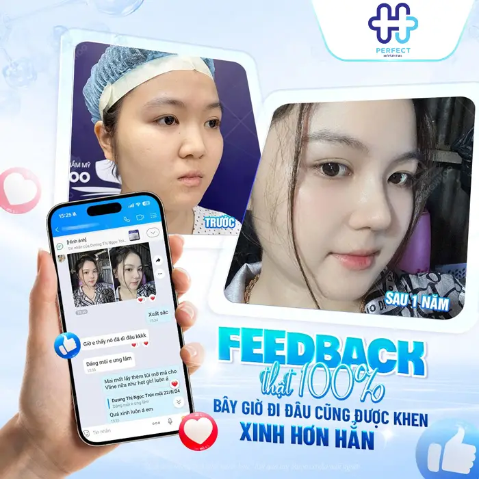 Nâng Mũi Cấu Trúc 4D Nanoform Là Gì? Công Nghệ Tạo Dáng Mũi Hiện Đại