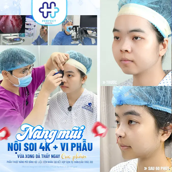 Nâng Mũi Chỉ Collagen Là Gì? Phương Pháp Này Có An Toàn Không?