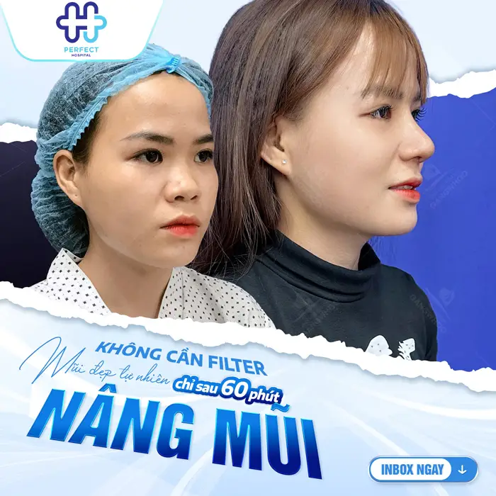 Nâng Mũi Có Đau Không? Phân Tích Mức Độ Đau Theo Từng Giai Đoạn