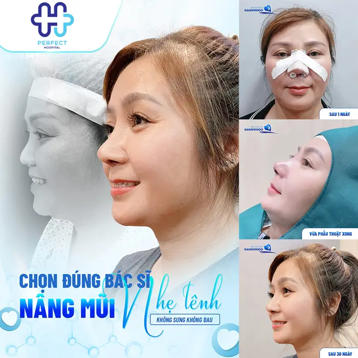 Nâng Mũi Có Đau Không? Phân Tích Mức Độ Đau Theo Từng Giai Đoạn