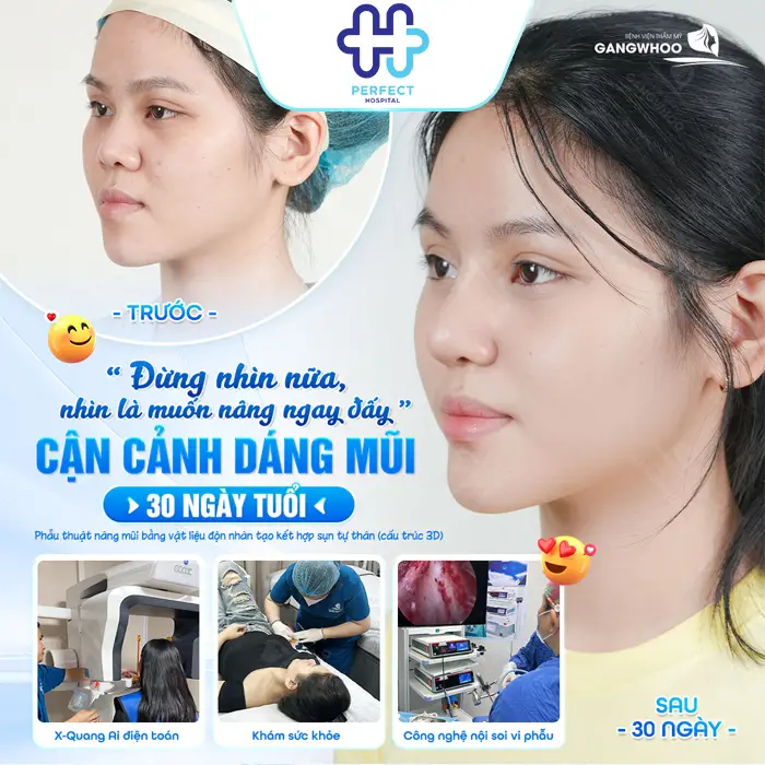 Nâng Mũi Có Đau Không? Phân Tích Mức Độ Đau Theo Từng Giai Đoạn