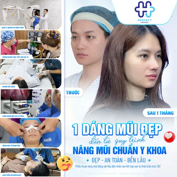 Nâng Mũi Được Bao Lâu? Có Giữ Được Lâu Không? Giải Đáp Chi Tiết