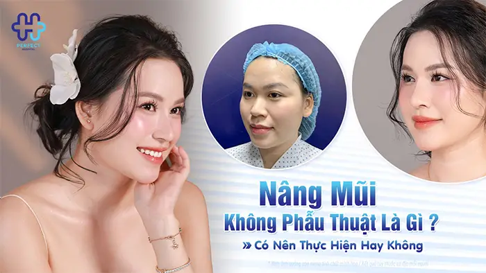 Nâng Mũi Không Phẫu Thuật Là Gì? Có Nên Thực Hiện Hay Không