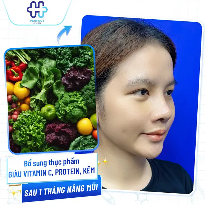 Nâng Mũi Kiêng Ăn Bao Lâu? Thời Gian Ăn Uống Bình Thường Sau Phẫu Thuật