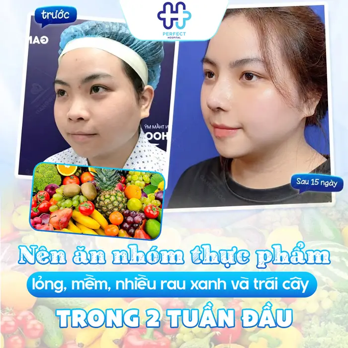 Nâng Mũi Kiêng Ăn Bao Lâu? Thời Gian Ăn Uống Bình Thường Sau Phẫu Thuật