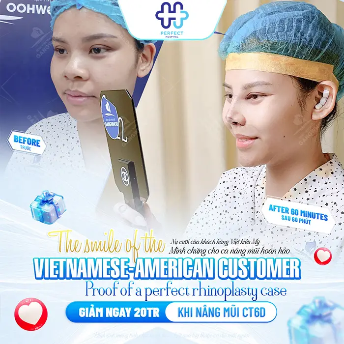 Nâng Mũi L Line Là Gì? Dáng Mũi Cao Tây Được Ưa Chuộng Hiện Nay