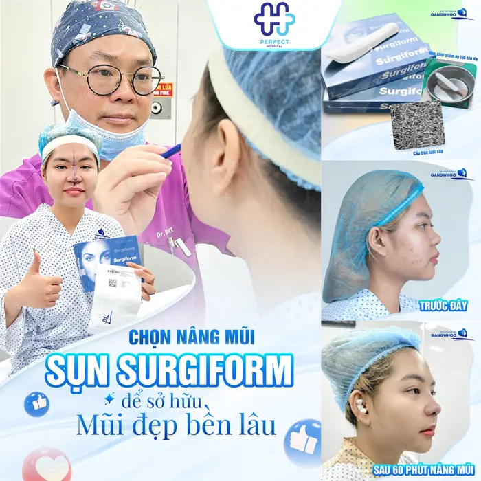Nâng Mũi Surgiform Là Gì? Giải Pháp Tạo Dáng Mũi Hiện Đại