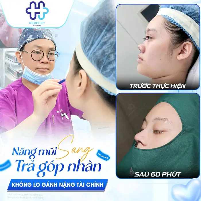 Nâng Mũi Trả Góp Giá Bao Nhiêu? Chính Sách Trả Góp Tại Perfect Hospital
