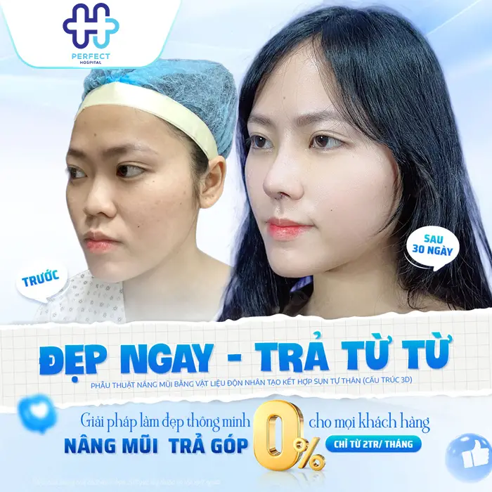 Nâng Mũi Trả Góp Giá Bao Nhiêu? Chính Sách Trả Góp Tại Perfect Hospital