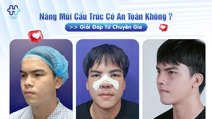 Nâng Mũi Cấu Trúc Có An Toàn Không? Giải Đáp Từ Chuyên Gia
