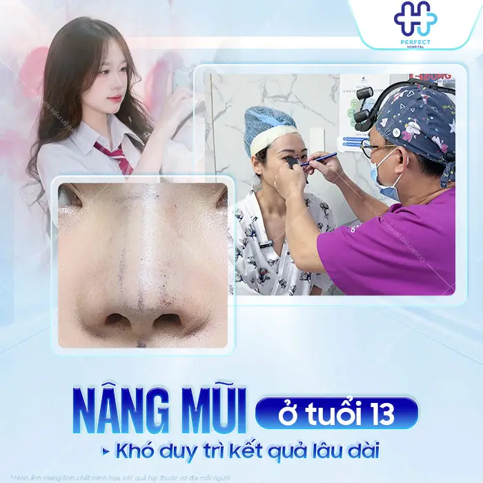 13 Tuổi Nâng Mũi Được Không? Độ Tuổi Phù Hợp Để Phẫu Thuật