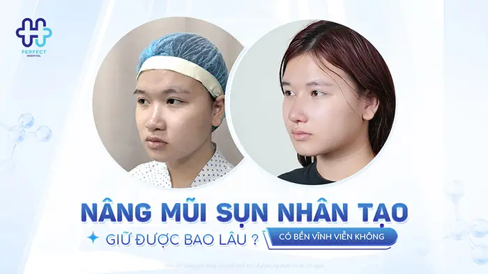 Nâng Mũi Sụn Nhân Tạo Giữ Được Bao Lâu? Có Bền Vĩnh Viễn Không