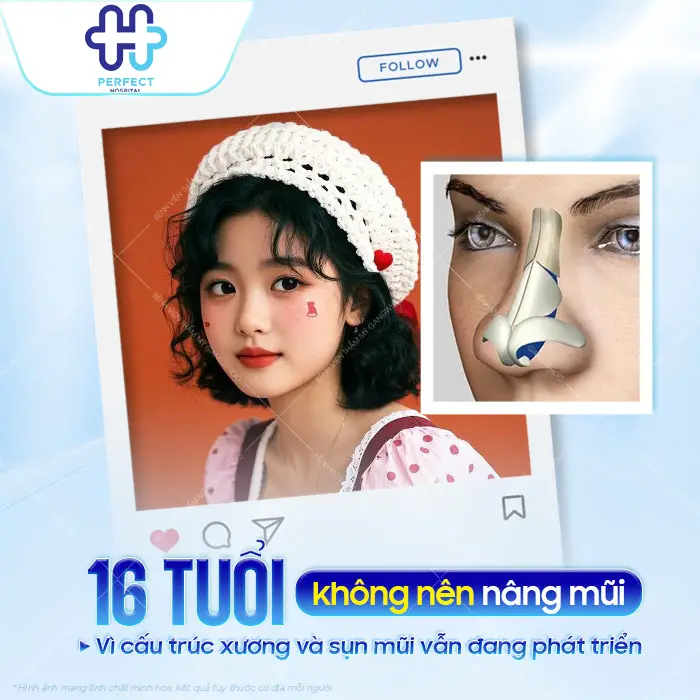 16 Tuổi Nâng Mũi Được Không? Độ Tuổi Phù Hợp Để Phẫu Thuật