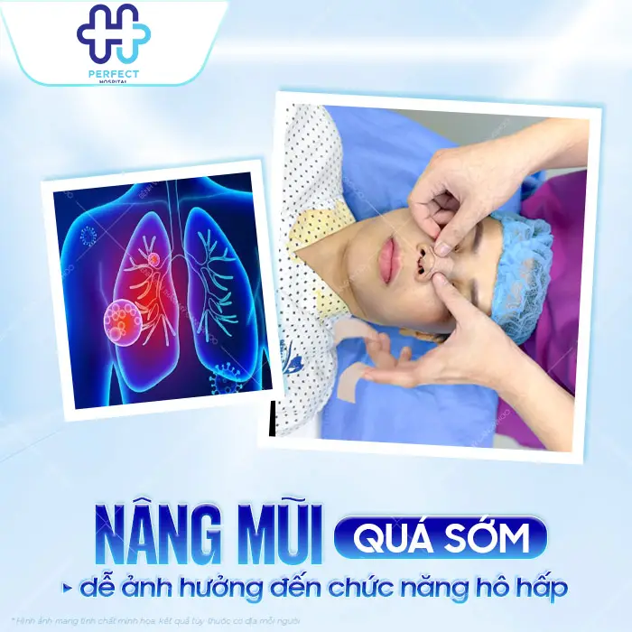 16 Tuổi Nâng Mũi Được Không? Độ Tuổi Phù Hợp Để Phẫu Thuật