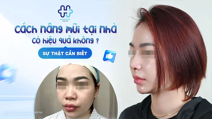 Cách nâng mũi tại nhà có hiệu quả không? Sự thật cần biết