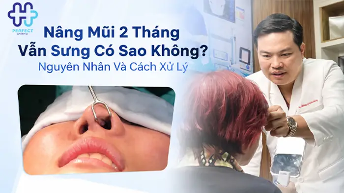 Nâng Mũi 2 Tháng Vẫn Sưng Có Sao Không? Nguyên Nhân Và Cách Xử Lý
