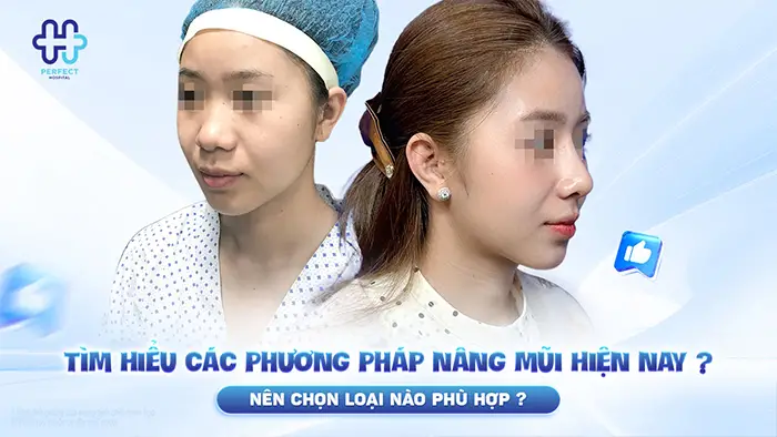 Tìm hiểu các phương pháp nâng mũi hiện nay ? Nên chọn loại nào phù hợp?